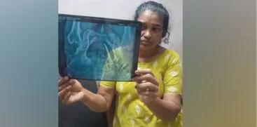 വണ്ടാനം മെഡിക്കൽ കോളേജിനെതിരെ പ്രതിഷേധം ശക്തം
